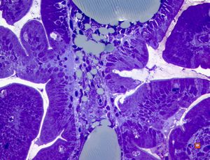 cured Whipple disease (semithin section) cured Whipple disease (semithin section)